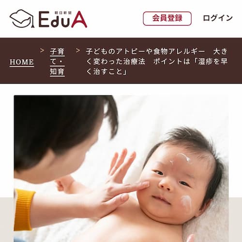 朝日新聞EduA | 子どものアトピーや食物アレルギー　大きく変わった治療法　ポイントは「湿疹を早く治すこと」